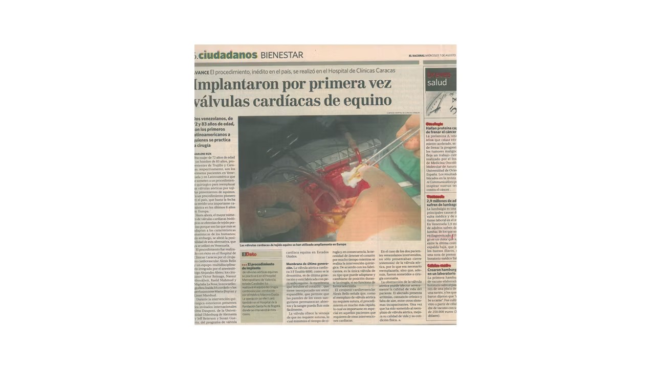 Prensa 13
